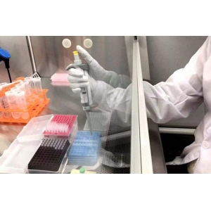 新型冠状病毒试剂盒不同检测方法分析